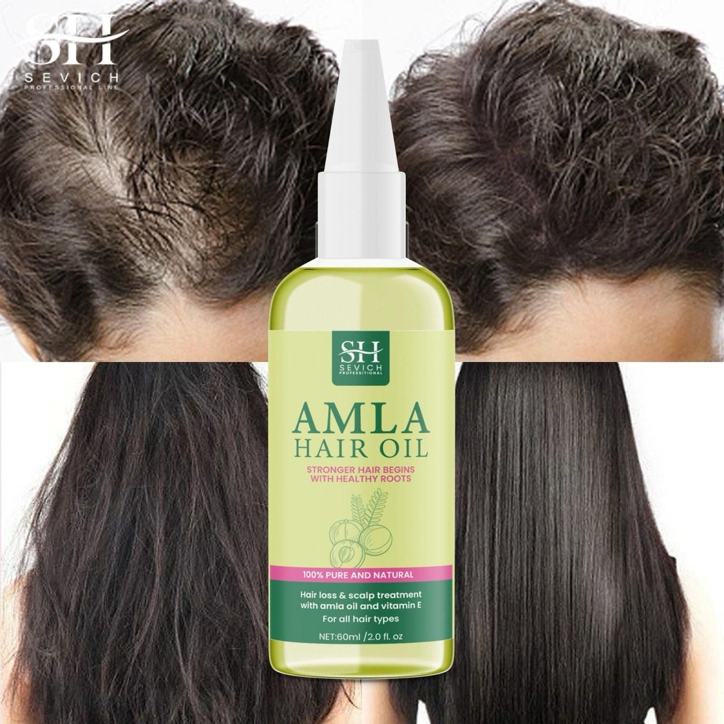 SH Amla Hair Oil 60ml - Nourish Your Hair Naturally (Pack of 2)